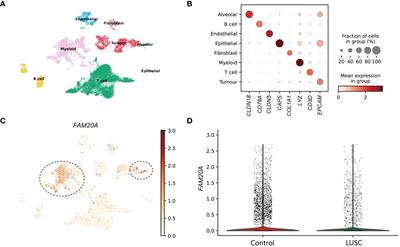 FAM20A: a potential diagnostic biomarker for lung squamous cell carcinoma